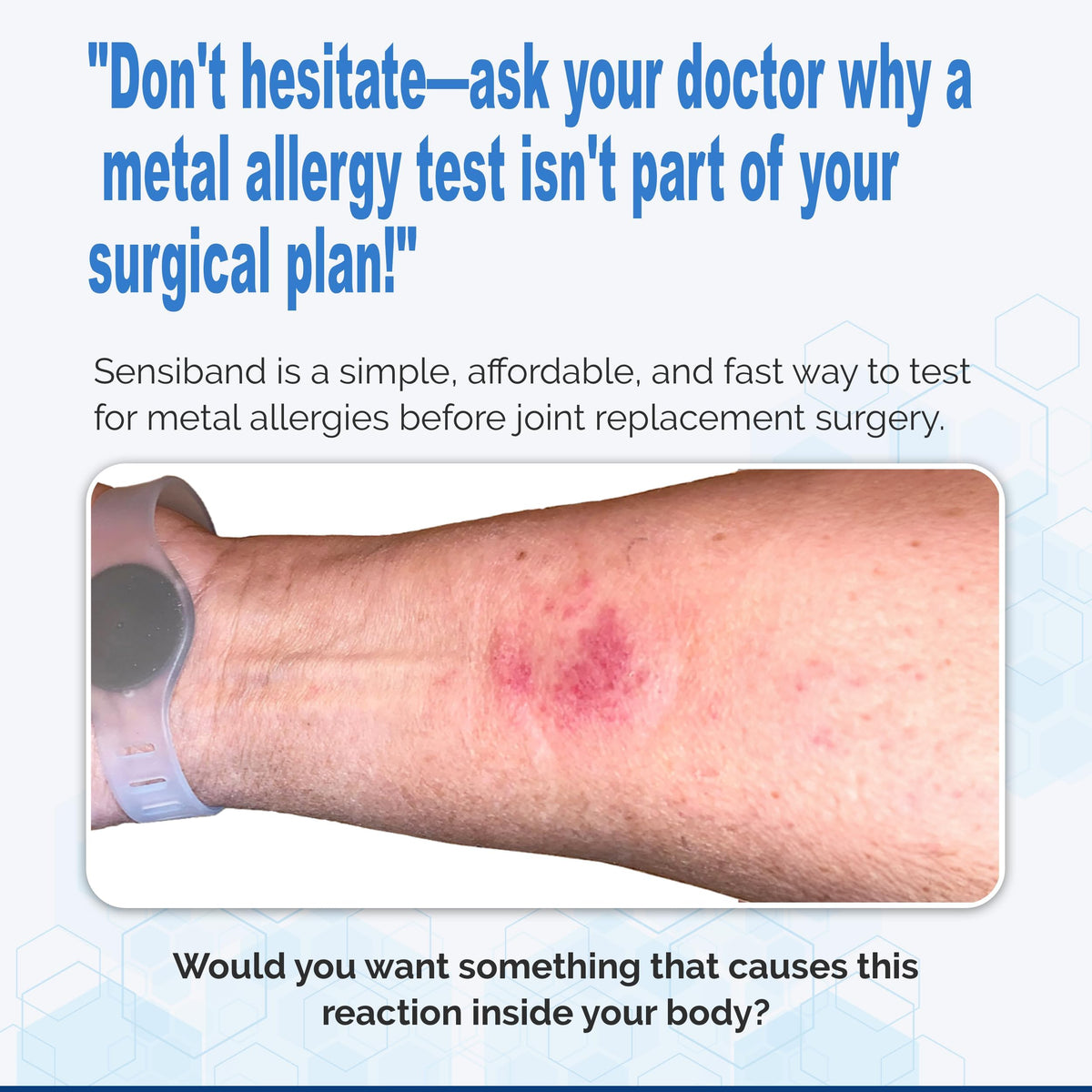 Metal Allergy Test Band for Metal Implants I42077